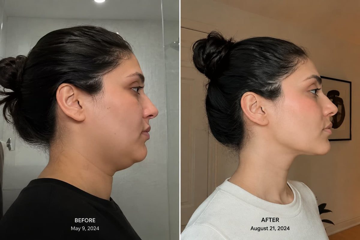 Before and after comparison
