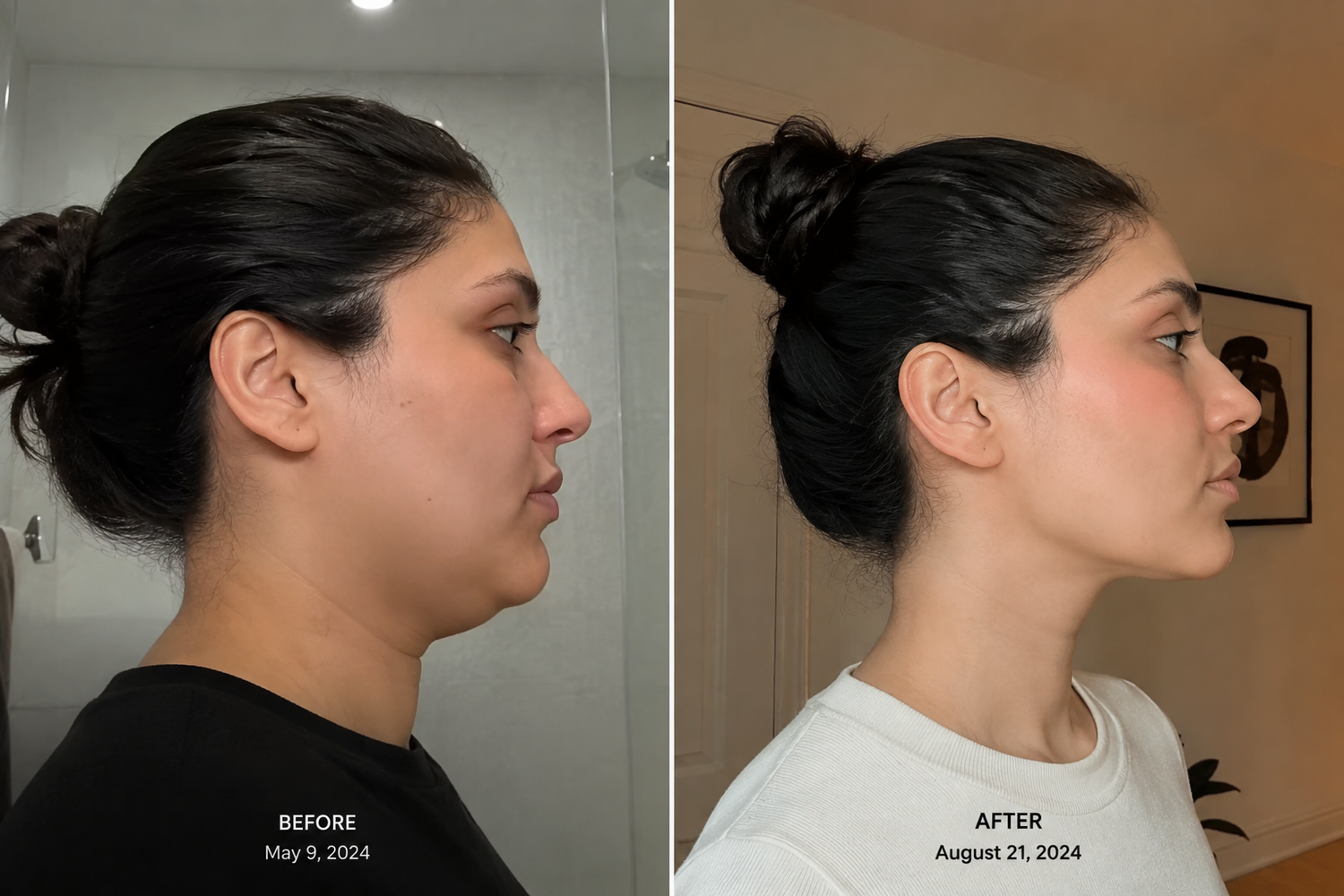 Before and after comparison